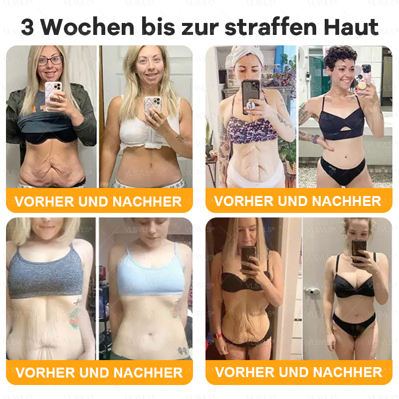 Hergestellt und versendet aus Deutschland ✨ VLSVLS® Bienengift Hautregenerationscreme 🔥 LETZTER TAG 80 % RABATT