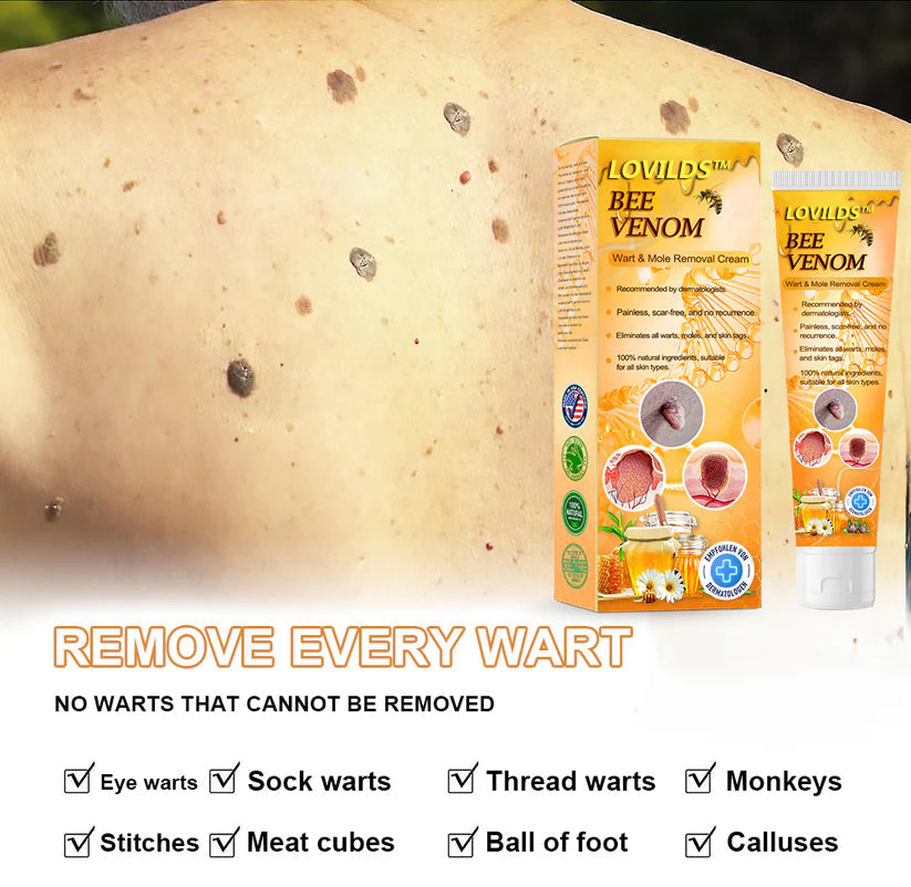 LOVILDS™ Bee Venom Wart & Tag Removal Cream(👨⚕Suitable for all skin types)🐝