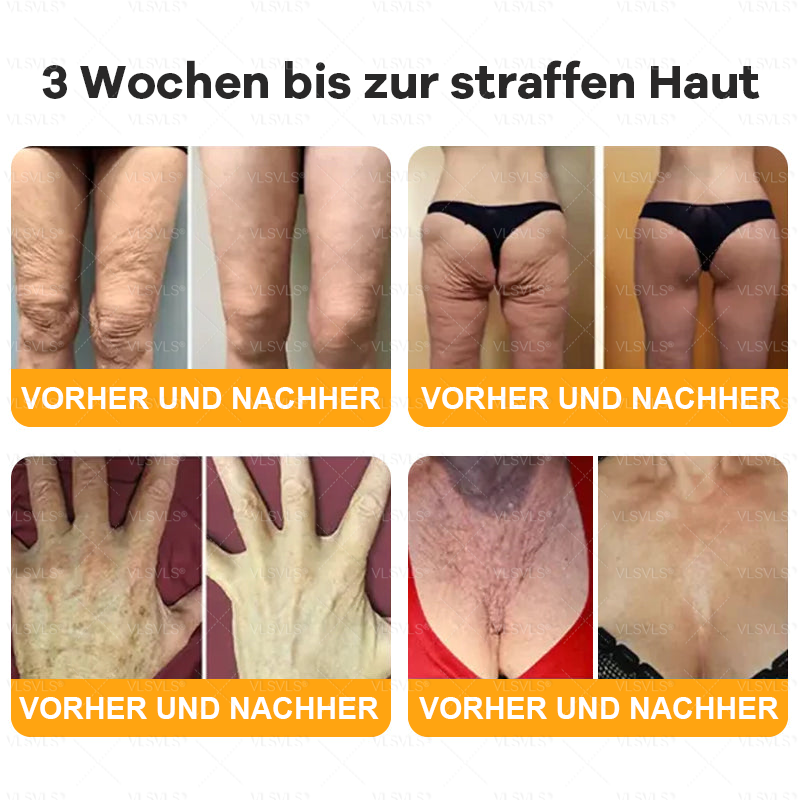 Hergestellt und versendet aus Deutschland ✨ VLSVLS® Bienengift Hautregenerationscreme 🔥 LETZTER TAG 80 % RABATT