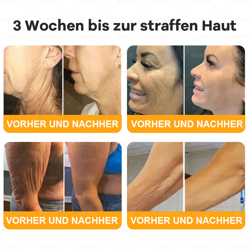 Hergestellt und versendet aus Deutschland ✨ VLSVLS® Bienengift Hautregenerationscreme 🔥 LETZTER TAG 80 % RABATT