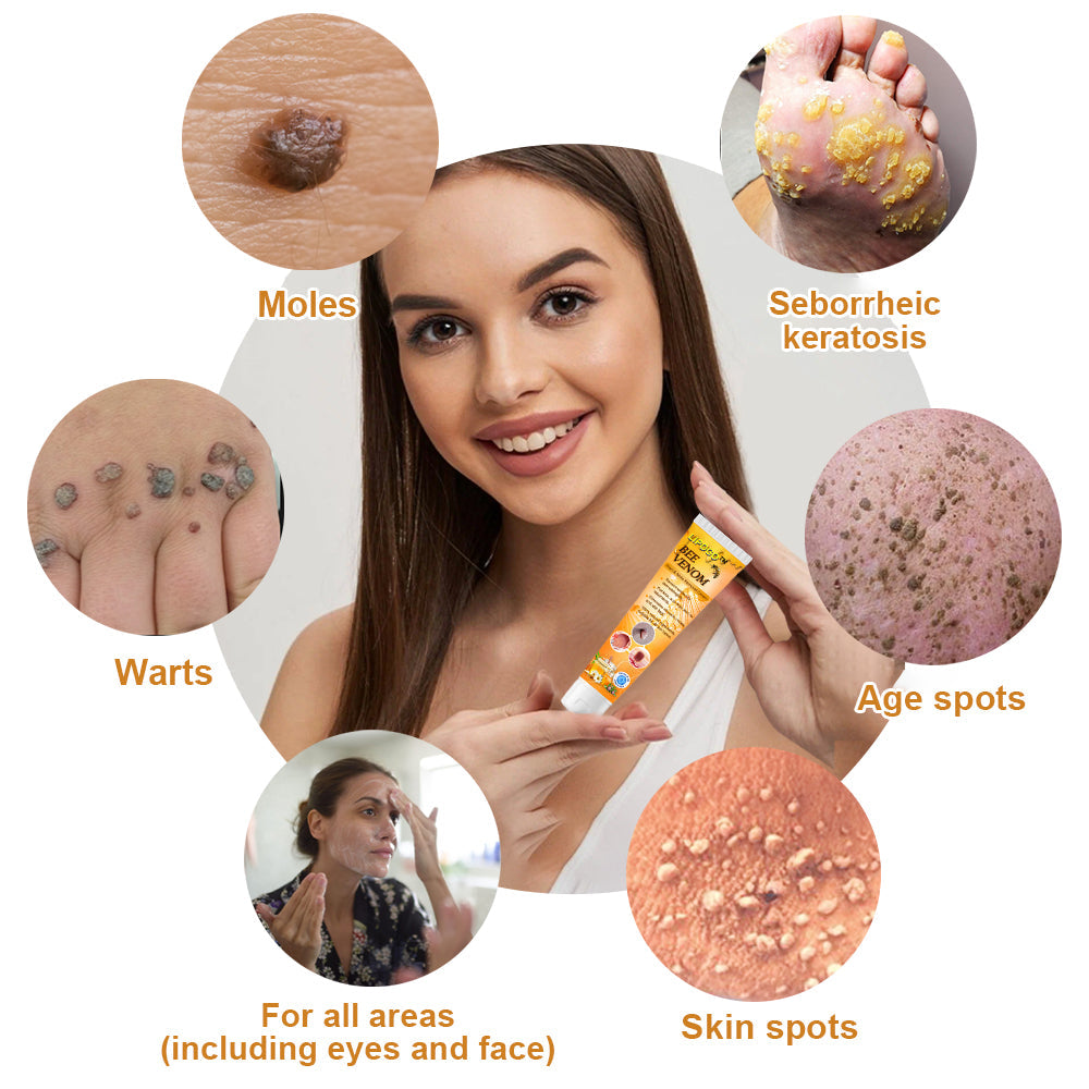 LOVILDS™ Bee Venom Wart & Tag Removal Cream(👨⚕Suitable for all skin types)🐝