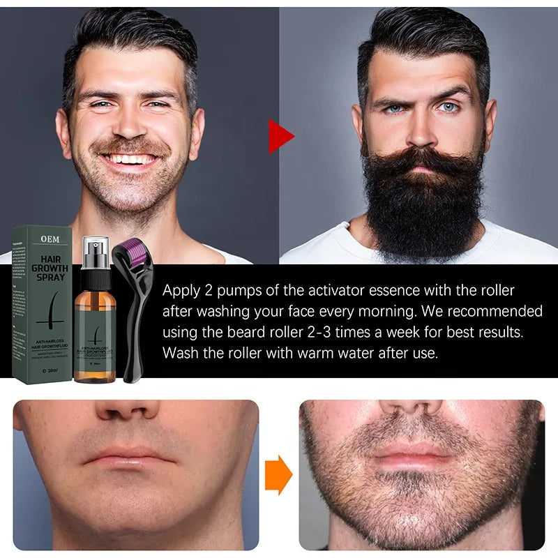 Organic Beard Growth Oil Spray for Men – Promotes Beard & Mustache Growth, Anti Hair Loss, Daily Use, 30ml