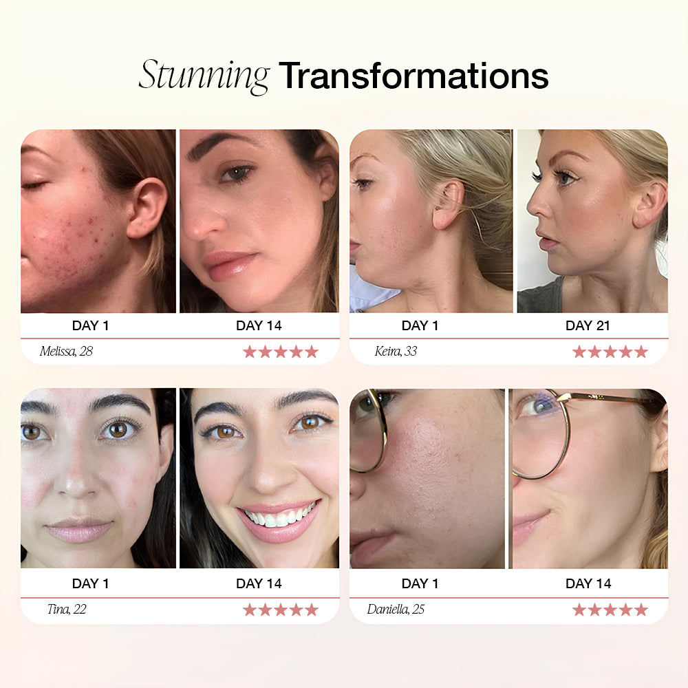 Avichic™ the ultimate face and neck massager