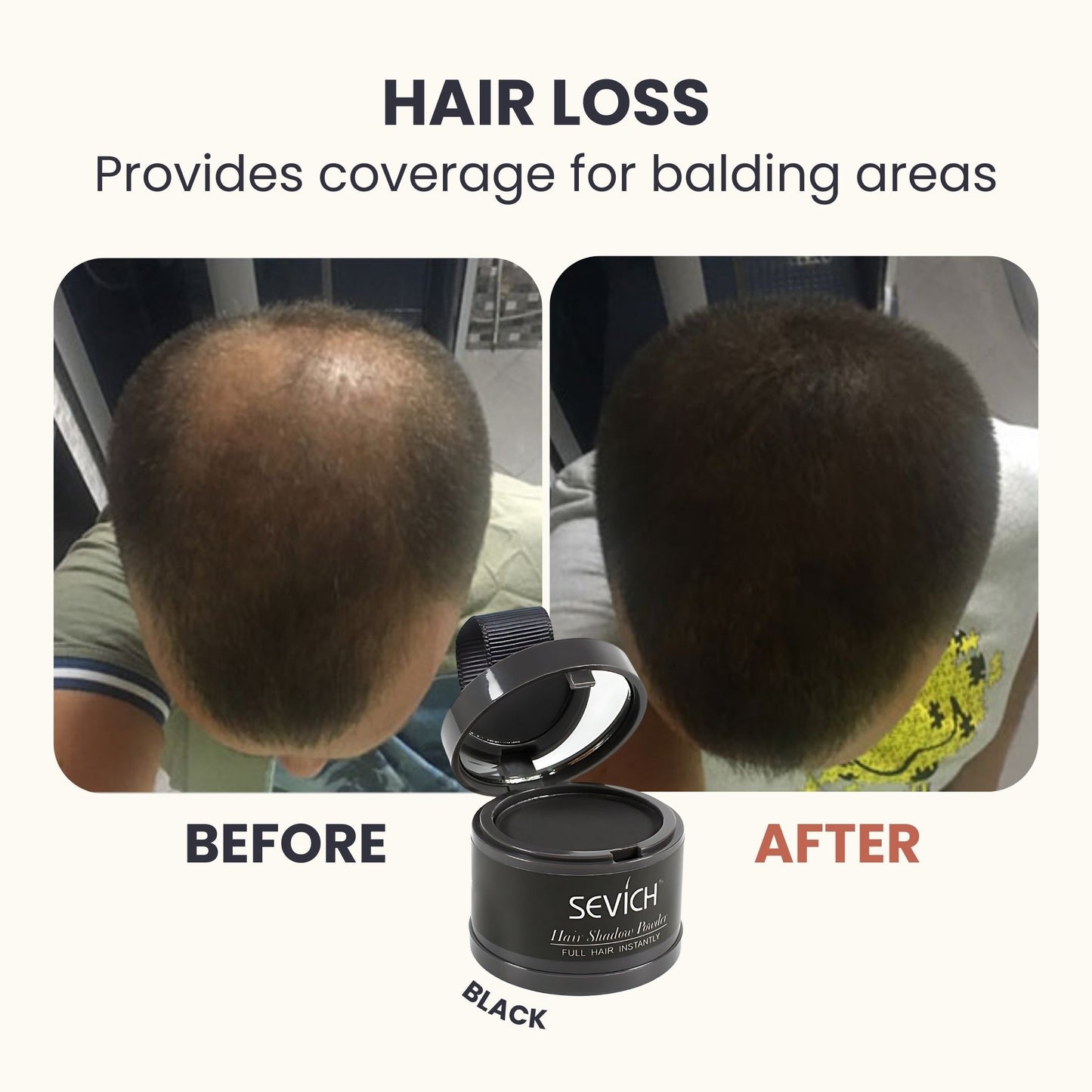 Hairline Powder – Waterproof Root Touch-Up & Hair Loss Concealer, 48H Coverage for Thinning, Bald Spots & Gray Roots