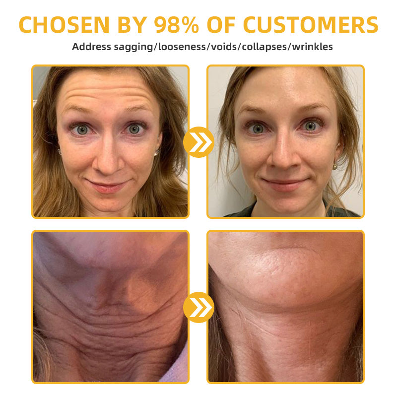 Bee Poison Retinol Skin Salve Ointment 🗽𝐀𝐀𝐃 𝐑𝐄𝐂𝐎𝐌𝐌𝐄𝐍𝐃𝐒(🔥50% Off for a Limited Time!)