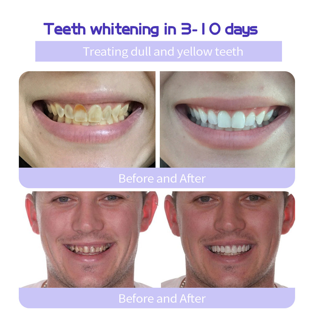 BBOJI™ TeethRestoration Mineral Powder(ADA recommended)