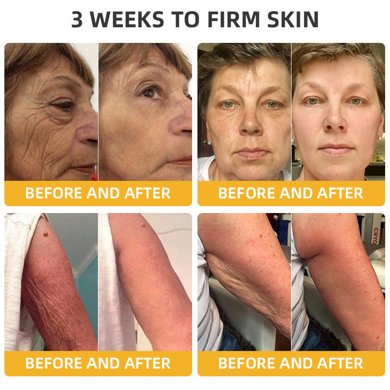 Bee Poison Retinol Skin Salve Ointment 🗽𝐀𝐀𝐃 𝐑𝐄𝐂𝐎𝐌𝐌𝐄𝐍𝐃𝐒(🔥50% Off for a Limited Time!)