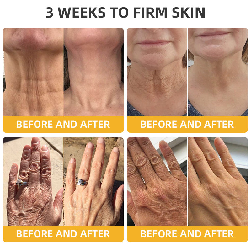 Bee Poison Retinol Skin Salve Ointment 🗽𝐀𝐀𝐃 𝐑𝐄𝐂𝐎𝐌𝐌𝐄𝐍𝐃𝐒(🔥50% Off for a Limited Time!)