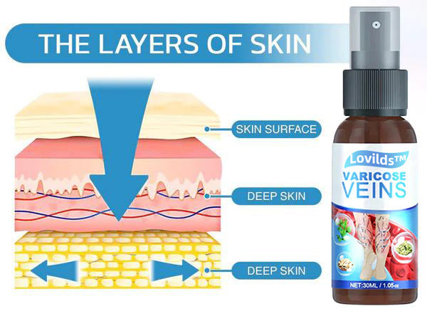 Lovild™ Varicose Veins Spray