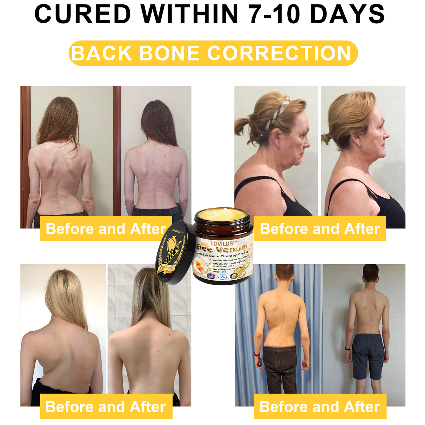 𝐀𝐫𝐭𝐡𝐫𝐢𝐭𝐢𝐬 𝐓𝐡𝐞𝐫𝐚𝐩𝐲 𝐂𝐫𝐞𝐚𝐦(👩‍🔬𝐒𝐩𝐞𝐜𝐢𝐚𝐥𝐢𝐳𝐢𝐧𝐠 𝐢𝐧 𝐨𝐫𝐭𝐡𝐨𝐩𝐞𝐝𝐢𝐜 𝐜𝐨𝐧𝐝𝐢𝐭𝐢𝐨𝐧𝐬 𝐚𝐧𝐝 𝐣𝐨𝐢𝐧𝐭 𝐩𝐚𝐢𝐧👩‍🔬)