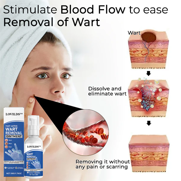 🔥LAST DAY 80% OFF 🔥 LOVILDS™ Fast-Active Wart Removal Ointment