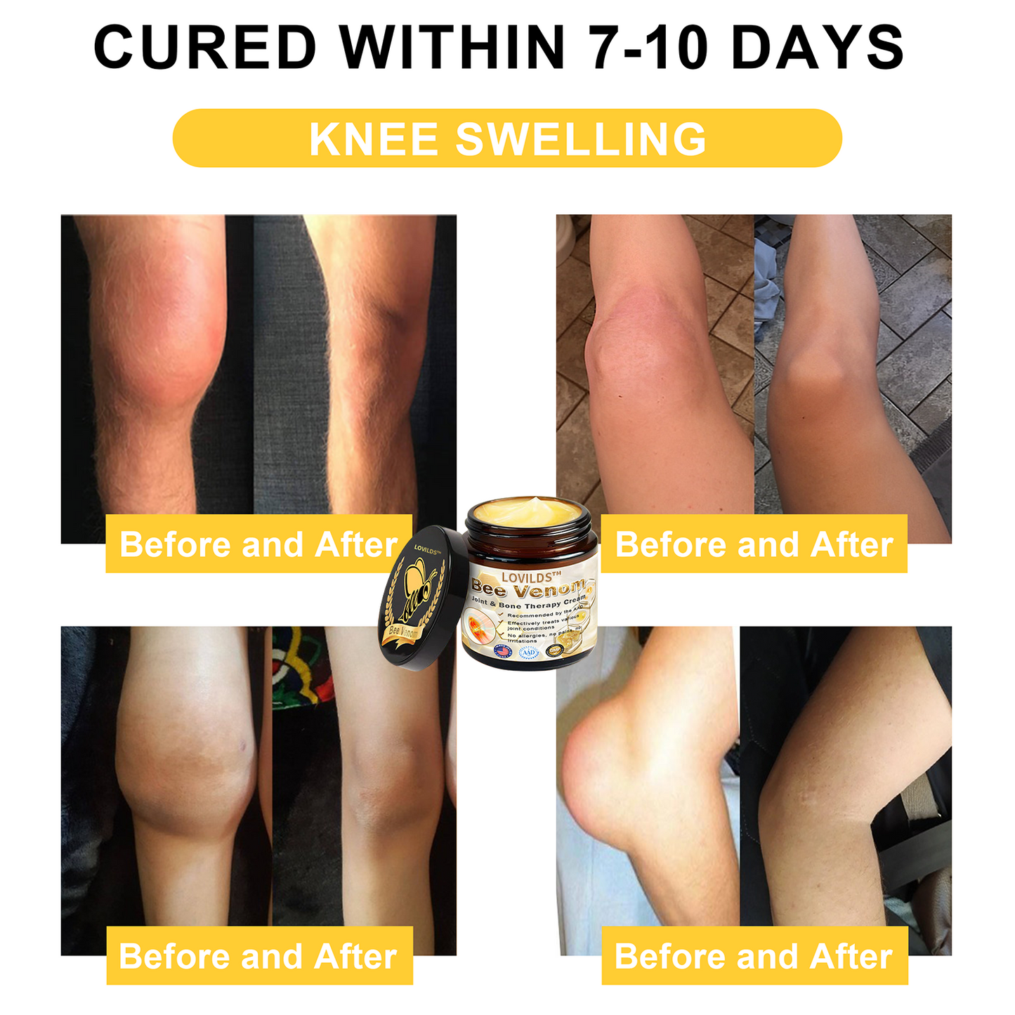 𝐀𝐫𝐭𝐡𝐫𝐢𝐭𝐢𝐬 𝐓𝐡𝐞𝐫𝐚𝐩𝐲 𝐂𝐫𝐞𝐚𝐦(👩‍🔬𝐒𝐩𝐞𝐜𝐢𝐚𝐥𝐢𝐳𝐢𝐧𝐠 𝐢𝐧 𝐨𝐫𝐭𝐡𝐨𝐩𝐞𝐝𝐢𝐜 𝐜𝐨𝐧𝐝𝐢𝐭𝐢𝐨𝐧𝐬 𝐚𝐧𝐝 𝐣𝐨𝐢𝐧𝐭 𝐩𝐚𝐢𝐧👩‍🔬)