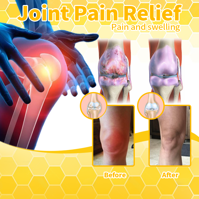 𝐀𝐫𝐭𝐡𝐫𝐢𝐭𝐢𝐬 𝐓𝐡𝐞𝐫𝐚𝐩𝐲 𝐂𝐫𝐞𝐚𝐦(👩‍🔬𝐒𝐩𝐞𝐜𝐢𝐚𝐥𝐢𝐳𝐢𝐧𝐠 𝐢𝐧 𝐨𝐫𝐭𝐡𝐨𝐩𝐞𝐝𝐢𝐜 𝐜𝐨𝐧𝐝𝐢𝐭𝐢𝐨𝐧𝐬 𝐚𝐧𝐝 𝐣𝐨𝐢𝐧𝐭 𝐩𝐚𝐢𝐧👩‍🔬)