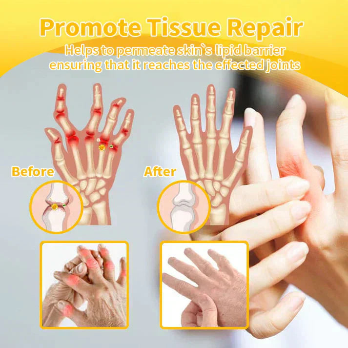 VENOLYX™ Bee Venom Rapid Therapy Joint Cream｜Deep Penetration for Joint Repair