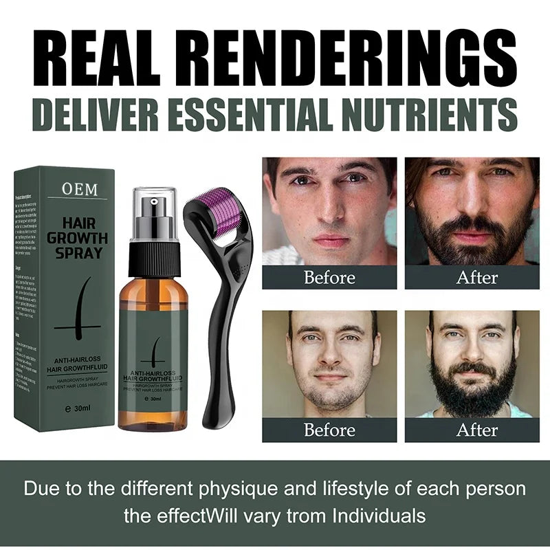Organic Beard Growth Oil Spray for Men – Promotes Beard & Mustache Growth, Anti Hair Loss, Daily Use, 30ml