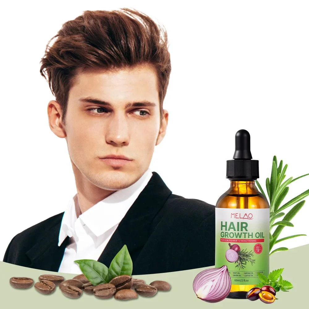 Natural Onion Hair Oil – Herbal Hair Growth Oil for Women, Anti-Hair Loss, Scalp Repair, Thickening, Moisturizing, 60ml