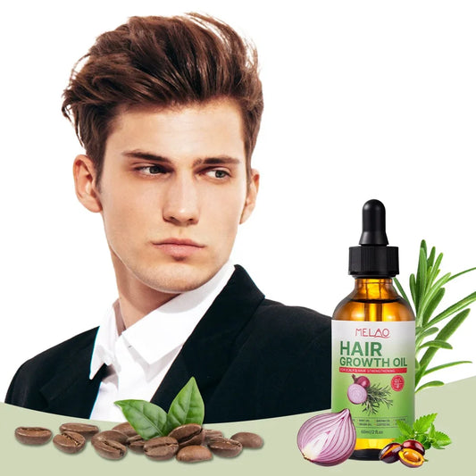 Natural Onion Hair Oil – Herbal Hair Growth Oil for Women, Anti-Hair Loss, Scalp Repair, Thickening, Moisturizing, 60ml