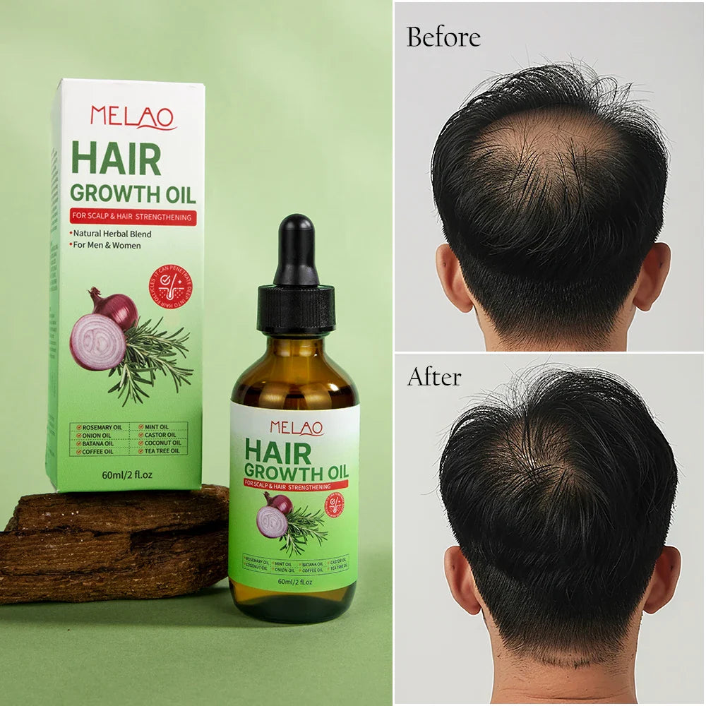 Natural Onion Hair Oil – Herbal Hair Growth Oil for Women, Anti-Hair Loss, Scalp Repair, Thickening, Moisturizing, 60ml