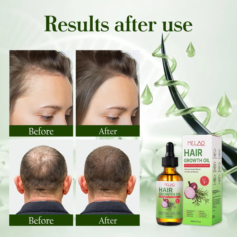 Natural Onion Hair Oil – Herbal Hair Growth Oil for Women, Anti-Hair Loss, Scalp Repair, Thickening, Moisturizing, 60ml