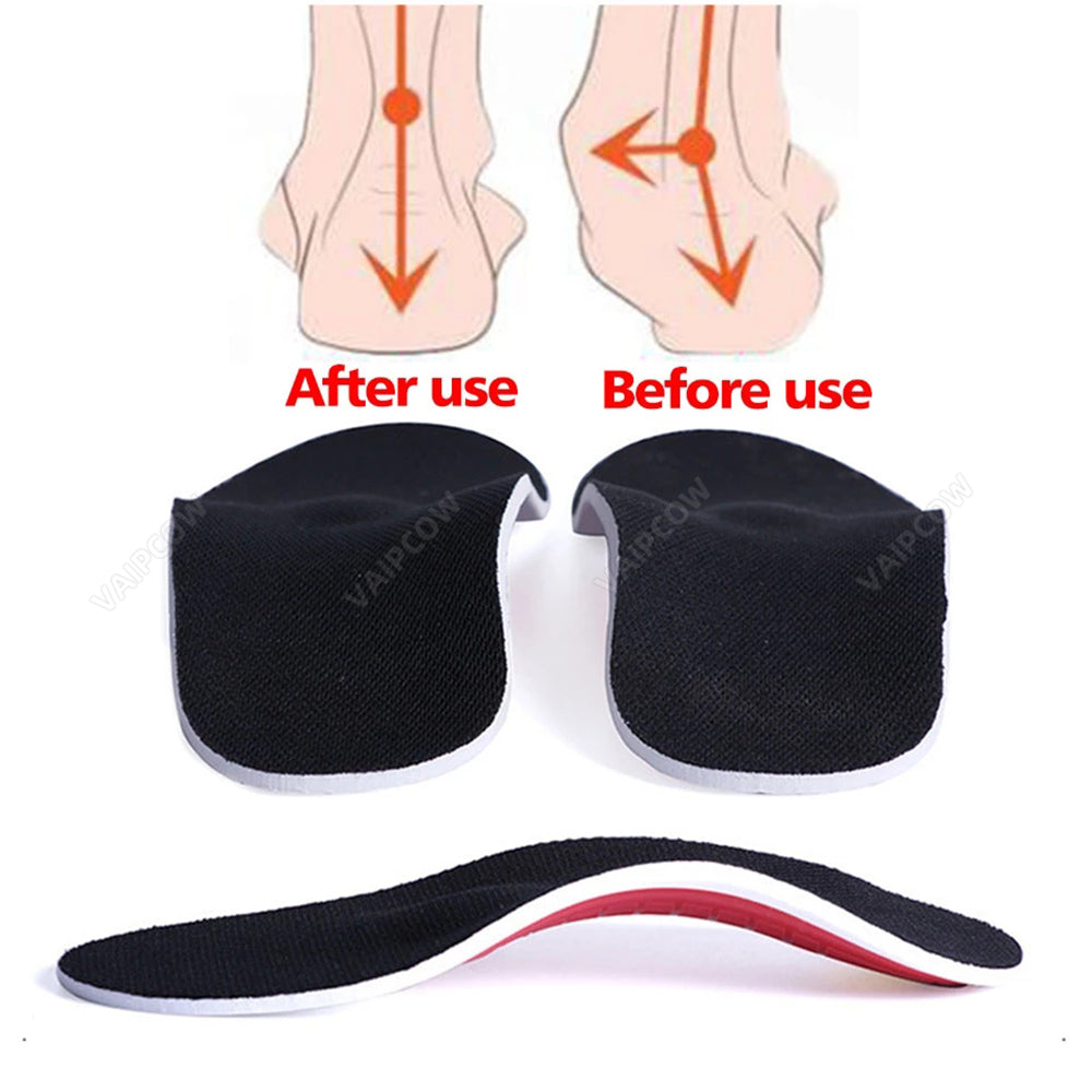 Avichic™ Arch Clouds - Orthopedic Arch Support Insoles