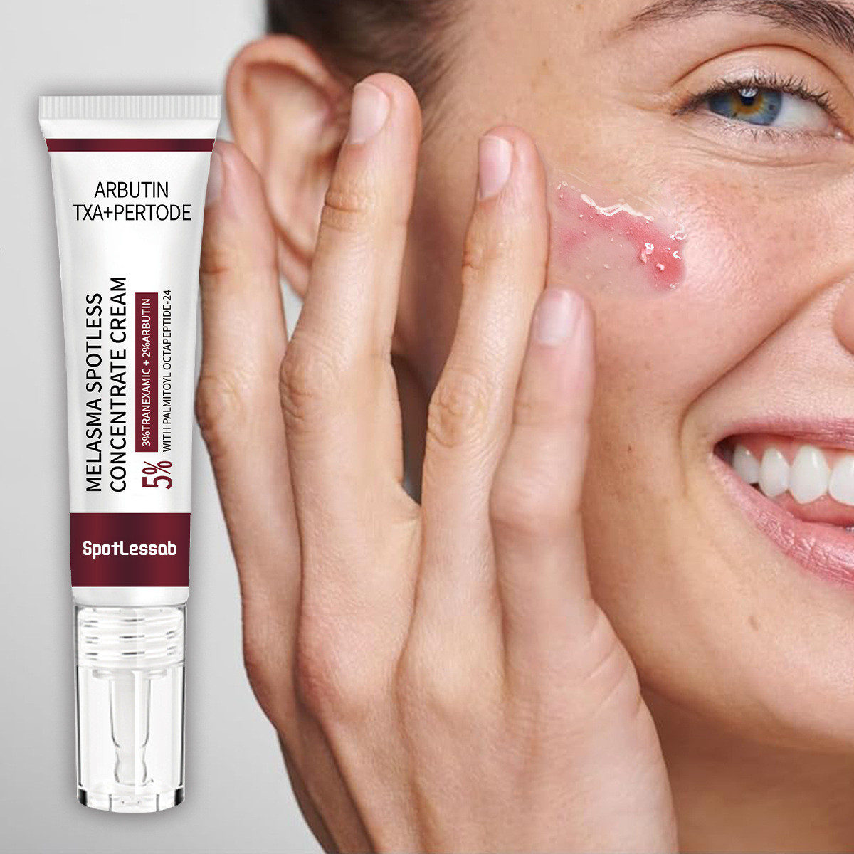 SpotLessab™ Radiance Dark Spot Correcting Cream – Target Stubborn Melasma & Freckles