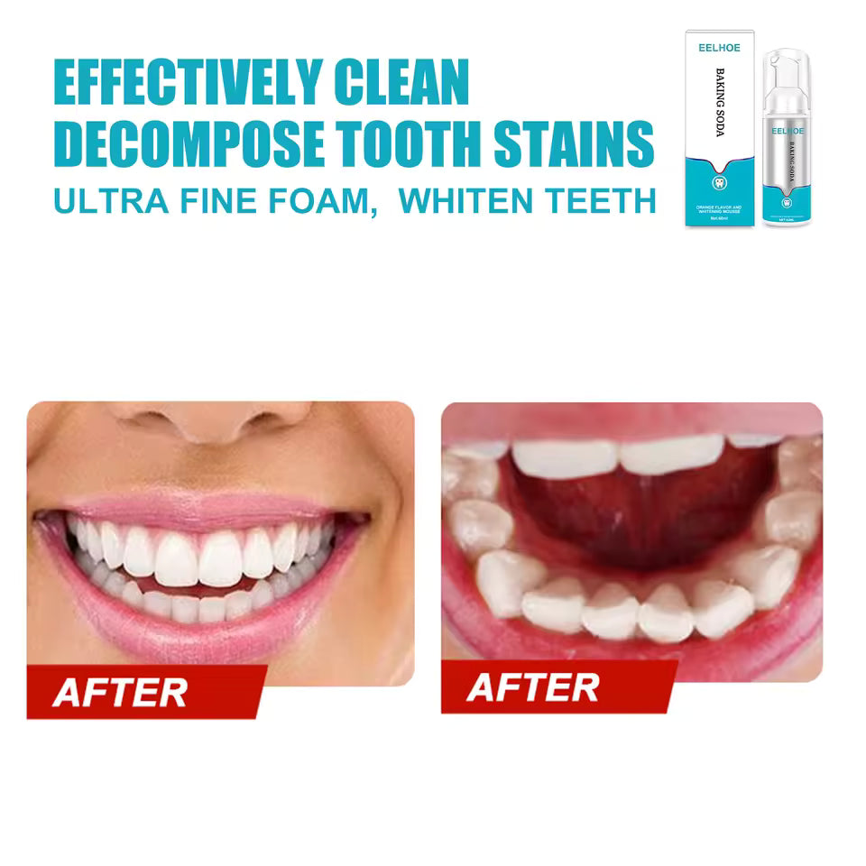 Tooth Cleaning Mousse – Whitening Foam Toothpaste for Yellow Tartar, Plaque & Smoke Stain Removal – Oral Hygiene Foam with Fresh Breath Care
