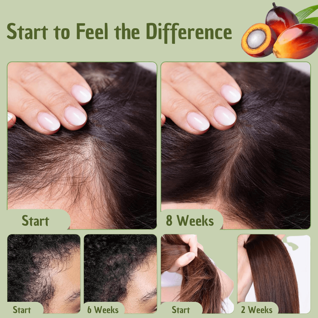 Batana Hair Oil – Boost Volume & Resilience for Thinning Hair | Confidence-Boosting Hair Repair Treatment