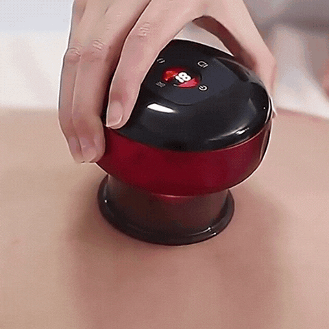 Smart Vacuum Cupping Device