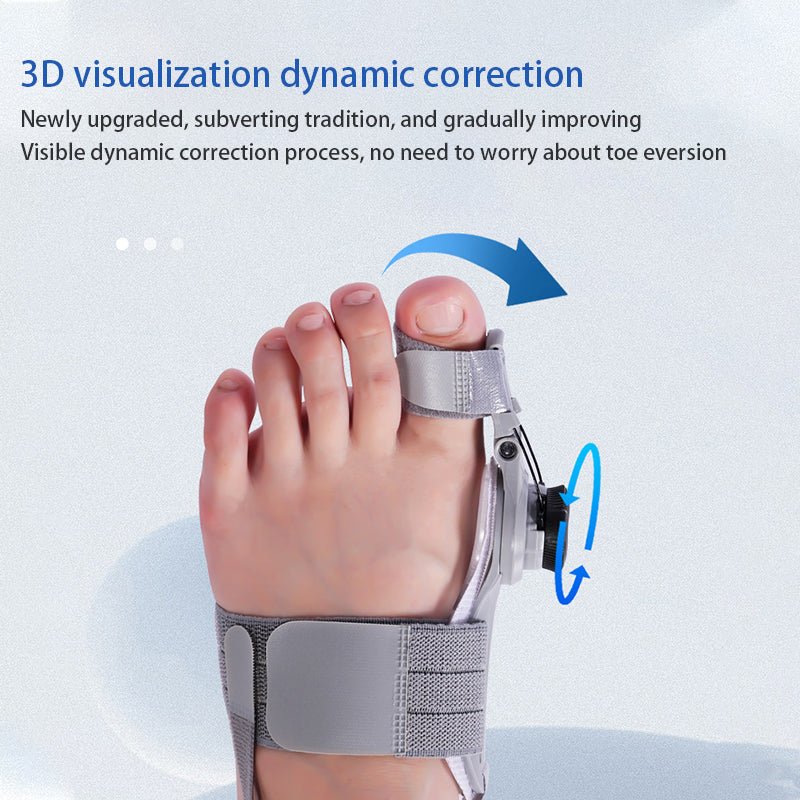 Hallux Helper – Gentle toe correction for bunions for pain-free walking