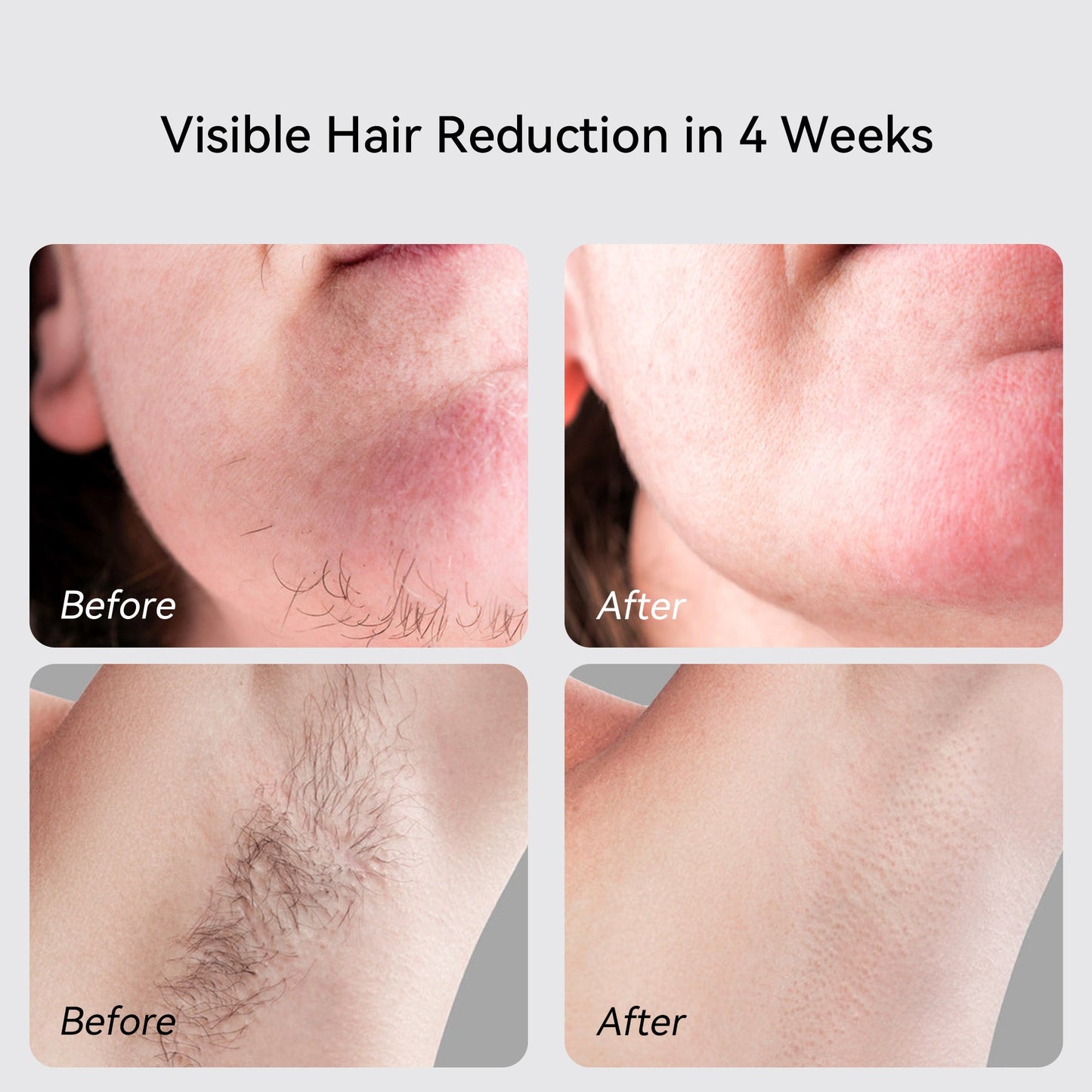 Avichic X Sapphire IPL Hair Removal Handset