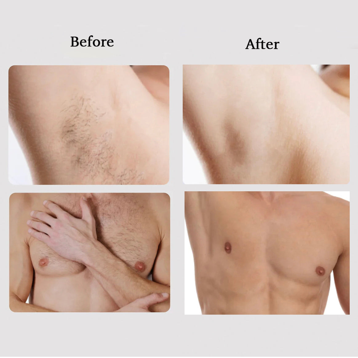 Avichic M1 Sapphire IPL Hair Removal Handset