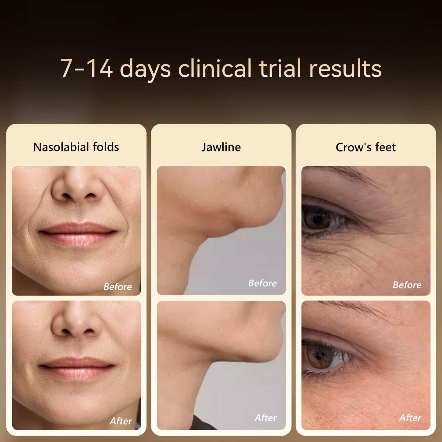 Avichic V1 Wireless Facial Massage Device